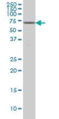 Western Blot: Fgr Antibody (1B12) [H00002268-M03]