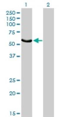 Western Blot: Fgr Antibody (1B12) [H00002268-M03]