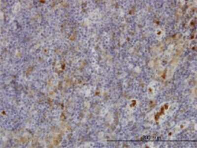 Immunohistochemistry-Paraffin: Fgr Antibody (3B11) [H00002268-M02]