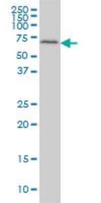 Western Blot: Fgr Antibody (3B11) [H00002268-M02]
