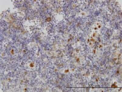 Immunohistochemistry-Paraffin: Fgr Antibody (3G10) [H00002268-M01]