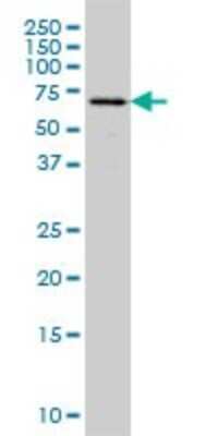 Western Blot: Fgr Antibody (3G10) [H00002268-M01]