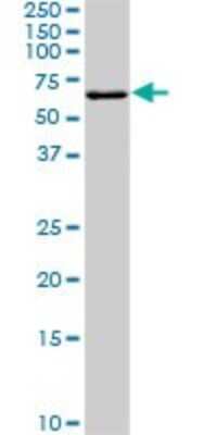 Western Blot: Fgr Antibody (3G10) [H00002268-M01]