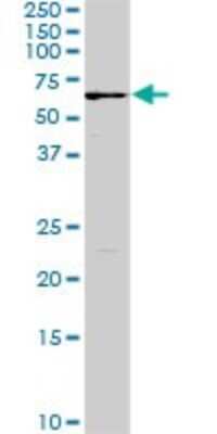 Western Blot: Fgr Antibody (3G10) [H00002268-M01]