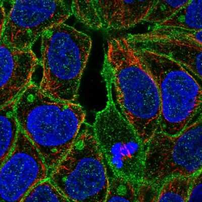 Immunocytochemistry/ Immunofluorescence: Fgr Antibody [NBP1-85677]