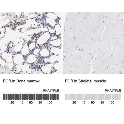 Immunohistochemistry-Paraffin: Fgr Antibody [NBP1-85677]