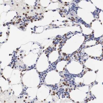 Immunohistochemistry-Paraffin: Fgr Antibody [NBP1-85677]