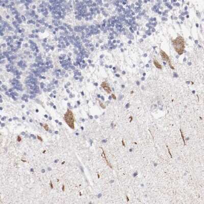 Immunohistochemistry-Paraffin: Fgr Antibody [NBP1-85677]