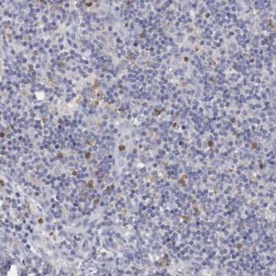 Immunohistochemistry-Paraffin: Fgr Antibody [NBP1-85677]