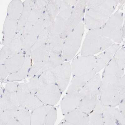 Immunohistochemistry-Paraffin: Fgr Antibody [NBP1-85677]