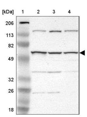 Western Blot: Fgr Antibody [NBP1-85677]