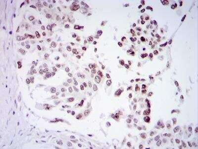 Immunohistochemistry-Paraffin: Fibrillarin Antibody (38F3) [NB300-269]