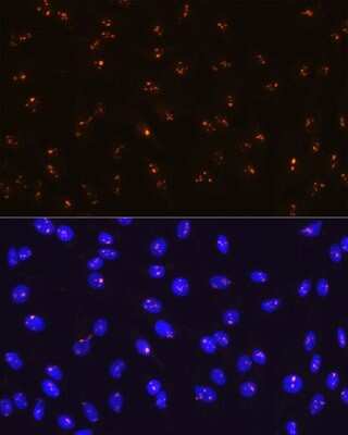 Immunocytochemistry/ Immunofluorescence: Fibrillarin Antibody (9J5O2) [NBP3-15312]