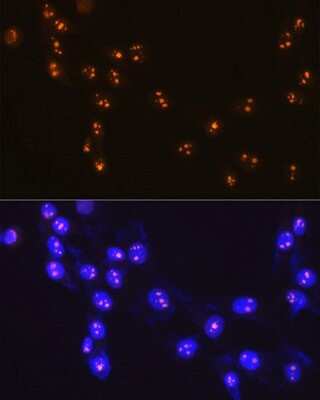 Immunocytochemistry/ Immunofluorescence: Fibrillarin Antibody (9J5O2) [NBP3-15312]