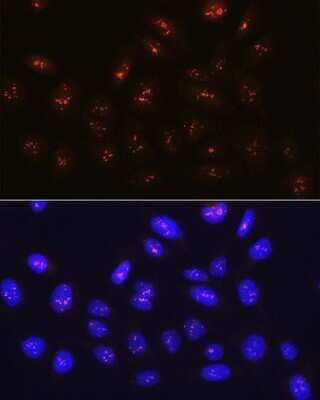 Immunocytochemistry/ Immunofluorescence: Fibrillarin Antibody (9J5O2) [NBP3-15312]