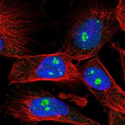 Immunocytochemistry/ Immunofluorescence: Fibrillarin Antibody [NBP2-58592]