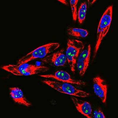 Immunocytochemistry/ Immunofluorescence: Fibrillarin Antibody [NBP2-46881]