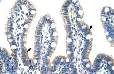 Immunohistochemistry-Paraffin: Fibrillarin Antibody [NBP1-57272]