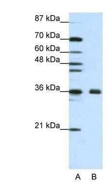 Western Blot: Fibrillarin Antibody [NBP1-57272]