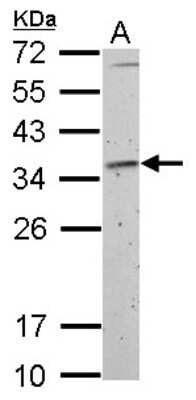 Western Blot: Fibrillarin Antibody [NBP2-16492]