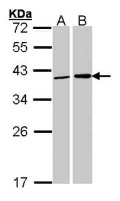Western Blot: Fibrillarin Antibody [NBP2-16492]