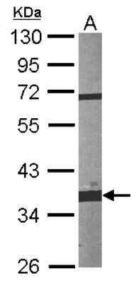 Western Blot: Fibrillarin Antibody [NBP2-16492]