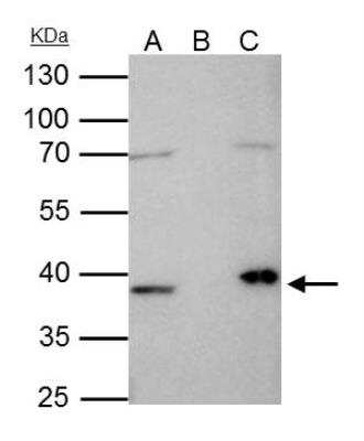 Western Blot: Fibrillarin Antibody [NBP2-16492]