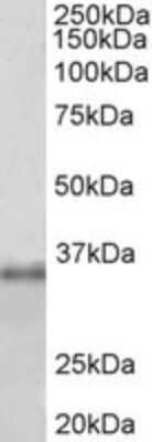 Western Blot: Fibrillarin Antibody [NBP2-26150]