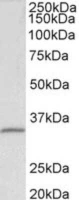 Western Blot: Fibrillarin Antibody [NBP2-26151]