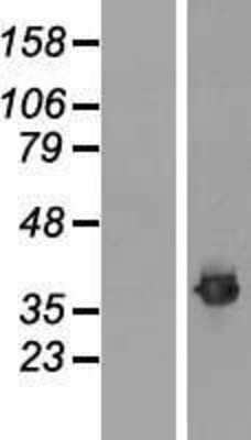 Western Blot: Fibrillarin Overexpression Lysate [NBL1-10607]