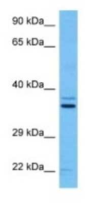 Western Blot: Fibrillarin like 1 Antibody [NBP3-10230]