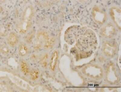 Immunohistochemistry-Paraffin: Fibrillin 1 Antibody (3H6) [H00002200-M01]