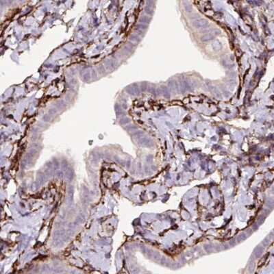 Immunohistochemistry-Paraffin: Fibrillin 1 Antibody (CL0225) [NBP2-52885]