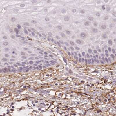 Immunohistochemistry-Paraffin: Fibrillin 1 Antibody (CL0225) [NBP2-52885]