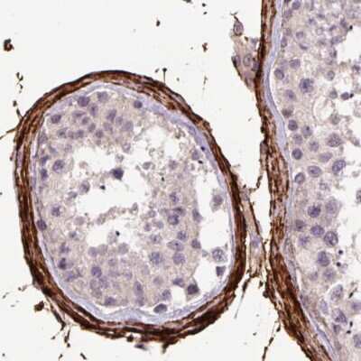 Immunohistochemistry-Paraffin: Fibrillin 1 Antibody (CL0225) [NBP2-52885]