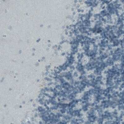 Immunohistochemistry-Paraffin: Fibrillin 1 Antibody (CL0226) [NBP2-52886]
