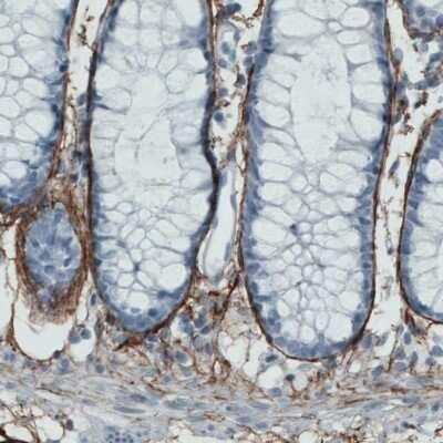 Immunohistochemistry-Paraffin: Fibrillin 1 Antibody (CL0226) [NBP2-52886]