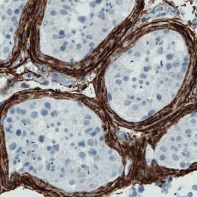 Immunohistochemistry-Paraffin: Fibrillin 1 Antibody (CL0226) [NBP2-52886]