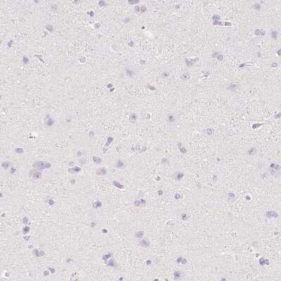 Immunohistochemistry-Paraffin: Fibrillin 1 Antibody [NBP1-84722]