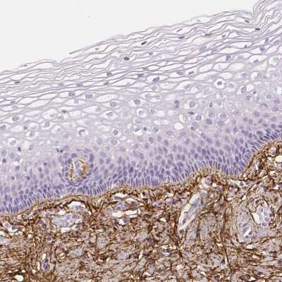 Immunohistochemistry-Paraffin: Fibrillin 1 Antibody [NBP1-84722]