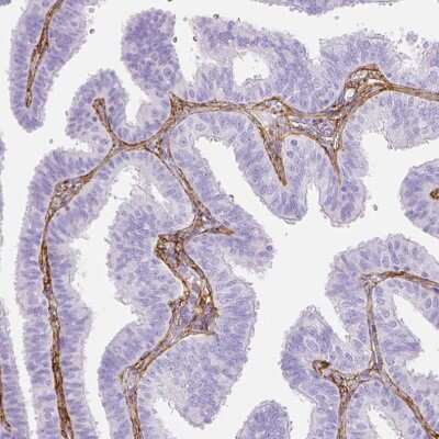 Immunohistochemistry-Paraffin: Fibrillin 1 Antibody [NBP1-84722]