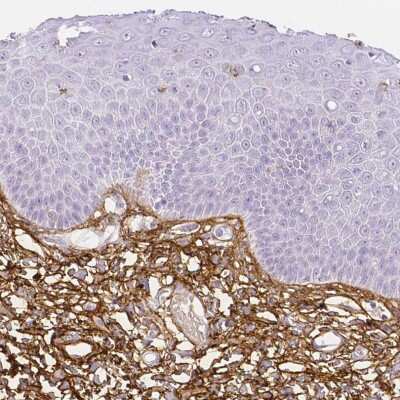 Immunohistochemistry-Paraffin: Fibrillin 1 Antibody [NBP1-84722]