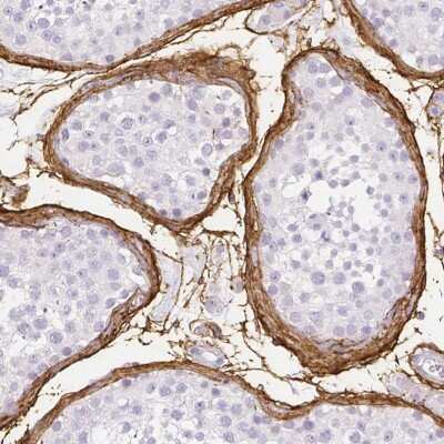 Immunohistochemistry-Paraffin: Fibrillin 1 Antibody [NBP1-84722]