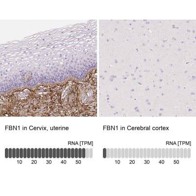 Immunohistochemistry-Paraffin: Fibrillin 1 Antibody [NBP1-84722]