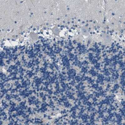 Immunohistochemistry-Paraffin: Fibrillin 1 Antibody [NBP1-84723]