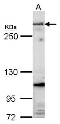 Western Blot: Fibrillin 1 Antibody [NBP2-16493]