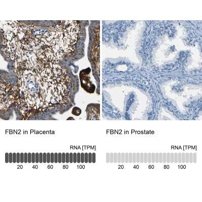 Immunohistochemistry-Paraffin: Fibrillin 2 Antibody [NBP1-88169]