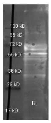 Western Blot: Fibrinogen Antibody [NBP2-50087]