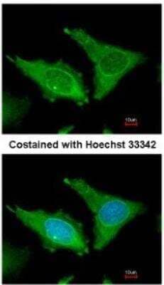 Immunocytochemistry/ Immunofluorescence: Fibrinogen beta chain Antibody [NBP1-33582]