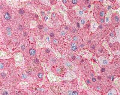 Immunohistochemistry-Paraffin: Fibrinogen Antibody [NBP2-50087]